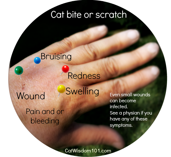cat bite-scratch pasteurella